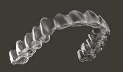 3Dスキャナーで精密な歯型を作成